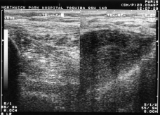 Vascular ultrasound scan image showing both lower extremities — the raw imaging sonographers work from